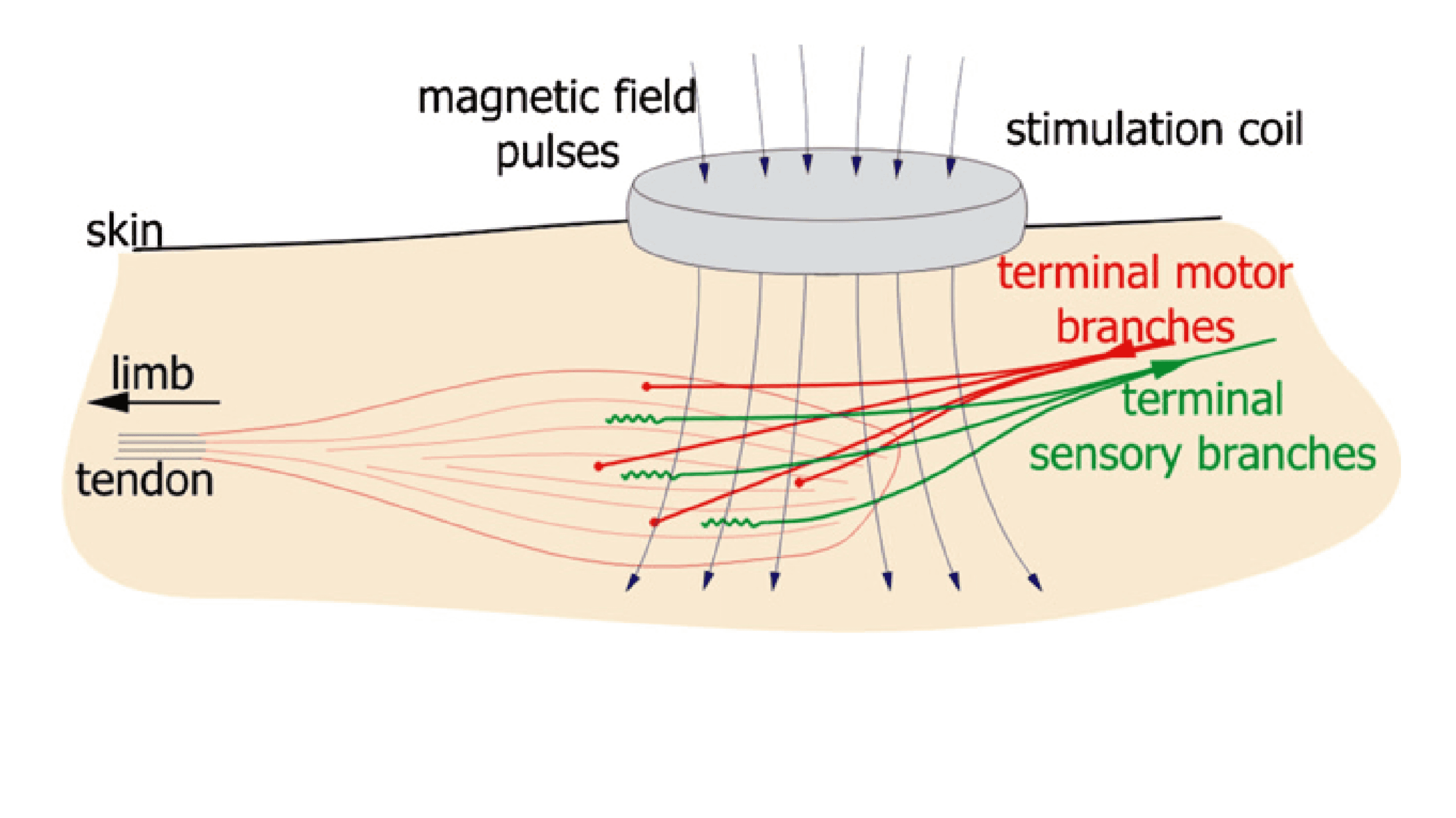 Principle of the mPNS application, (Bernhardt, Angerer et al. 2007)