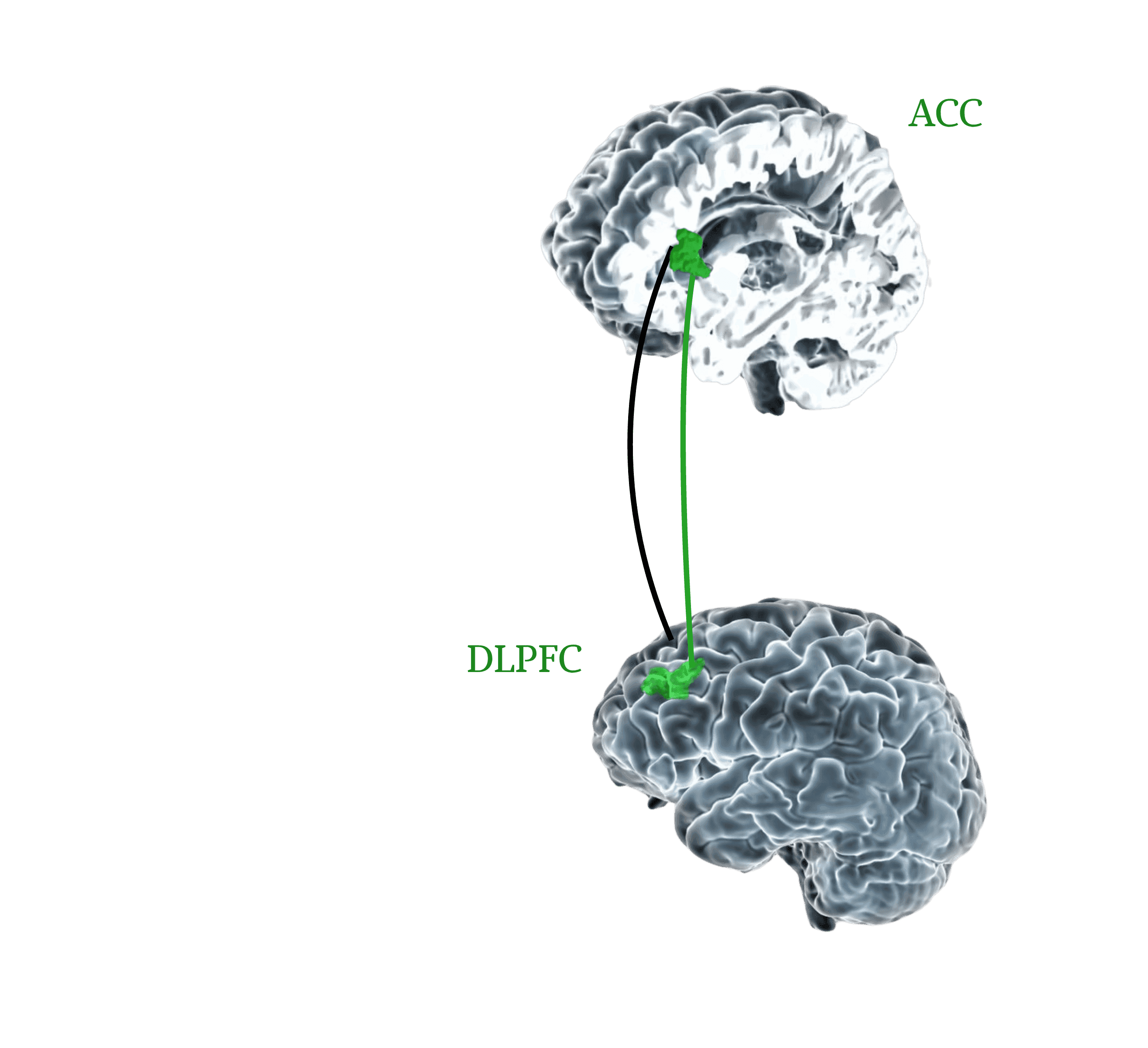 wyznaczanie miejsca stymulacji, protokół SAINT