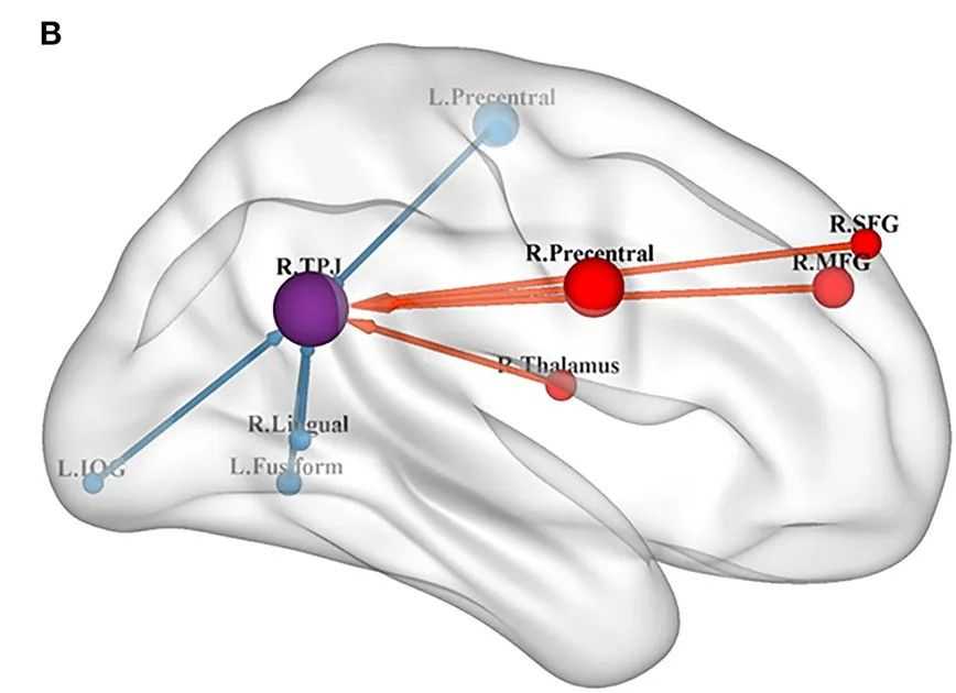 rTPJ connectivity autism